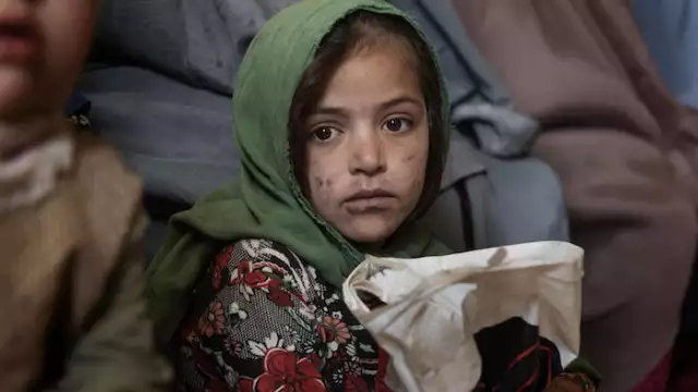 A girl in the waiting room of the UNICEF-supported Mirza Mohammad Khan clinic in Kandahar, Afghanistan. © UNICEF/UN0562566/ROMENZI