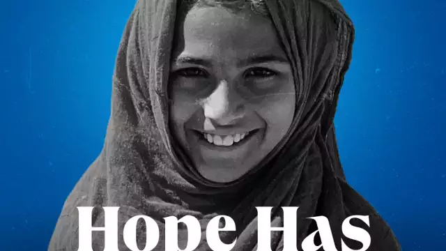 hope has a number 2 style3 1